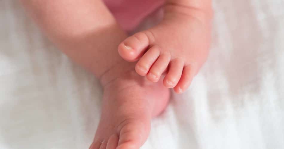 Ein Baby mit eingewachsenen Zehennägeln an den großen Zehen.